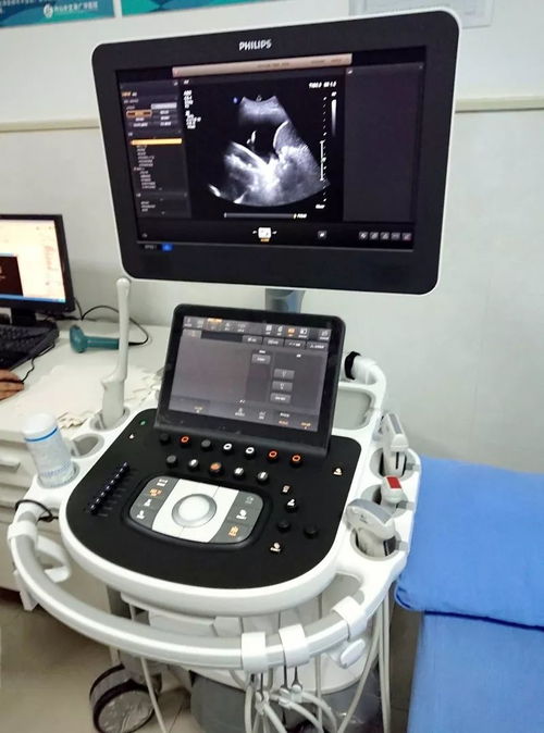 超聲檢查再添利器，來廣華體驗(yàn)國(guó)際高端彩超設(shè)備